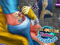 Ice Queen Tattoo Procedure image
